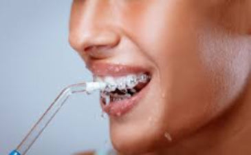 Irrigador Bucal AquaJet Pro